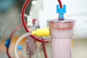 Part of a dialysis equipment during process of blood filtration