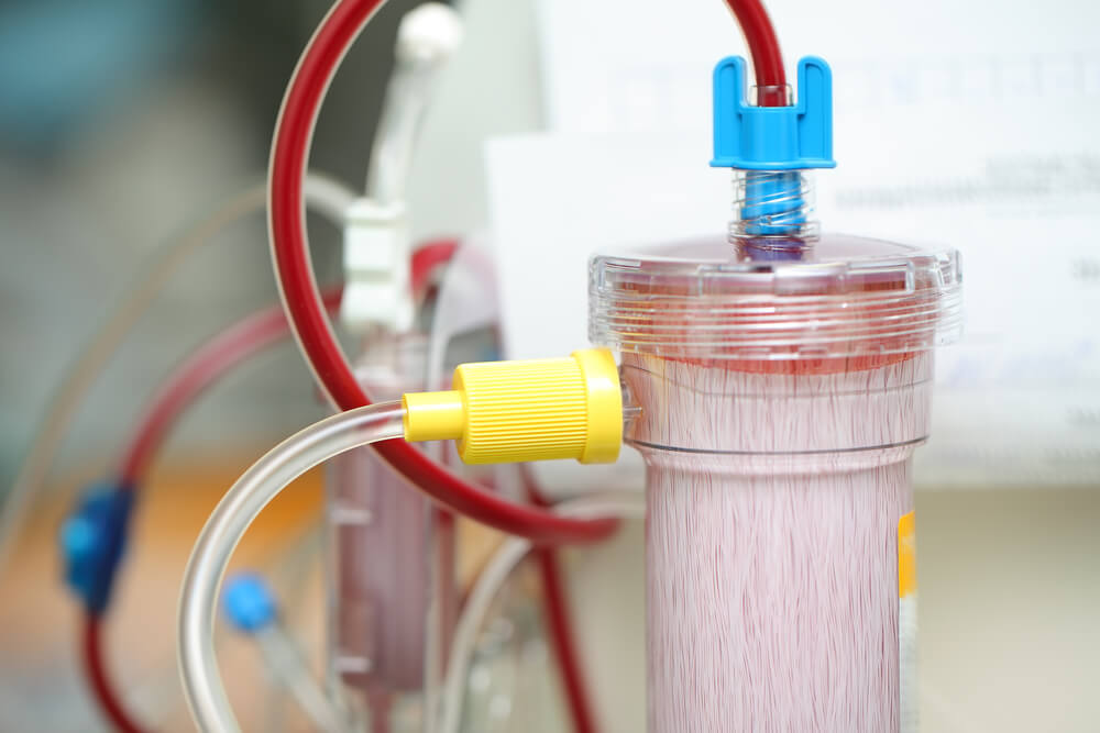 Dialysis membrane image